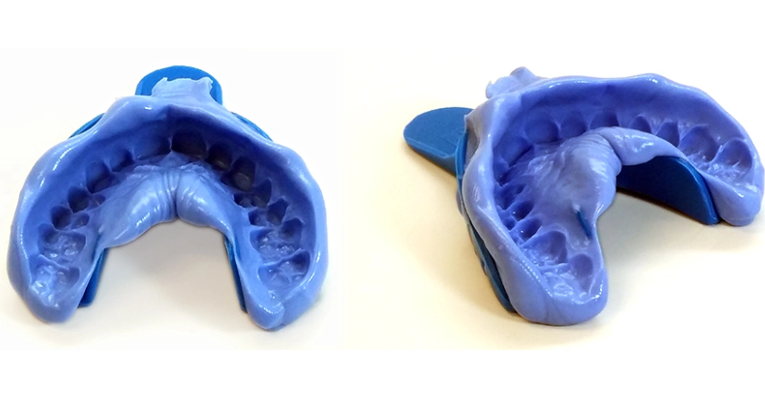 Dental Impressions 2